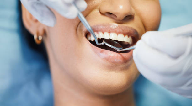 Best Emergency Dental Care for Broken or Chipped Teeth in Pahrump, NV